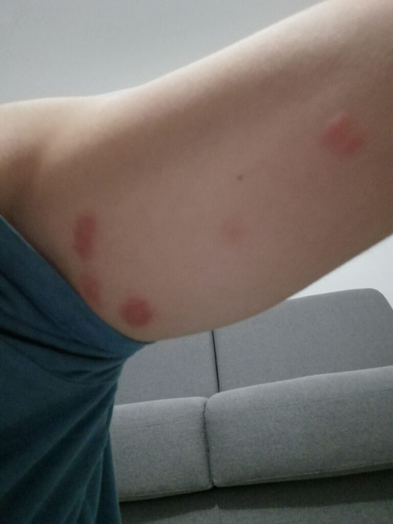 Piqures a la cinémathèque de paris